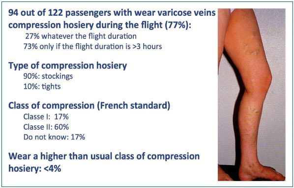 How Long Should You Wear Compression Socks After Knee Surgery? – Dunn  Medical